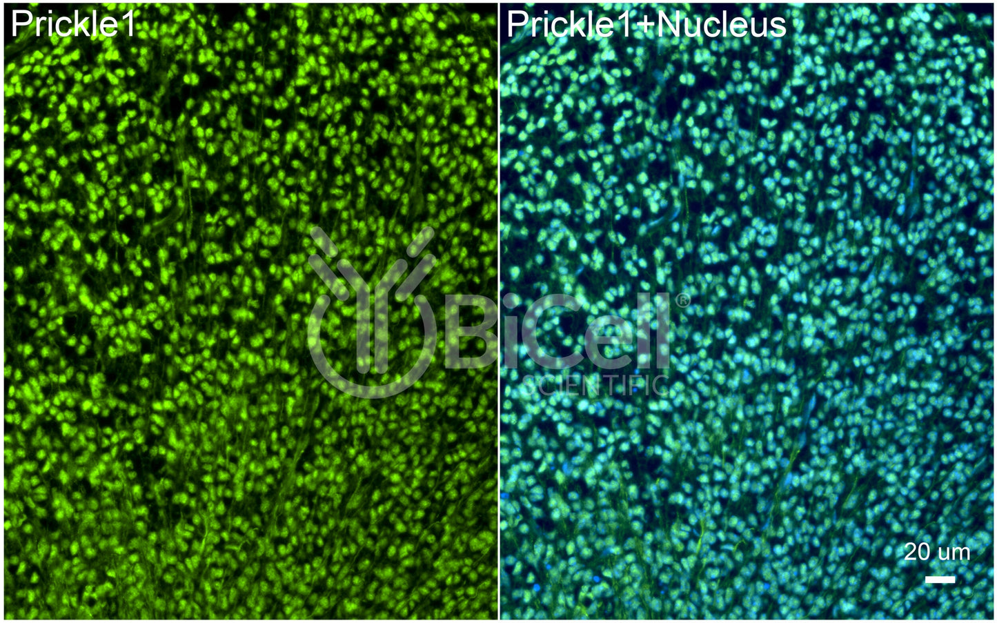 PRICKLE1 (RILP) Antibody