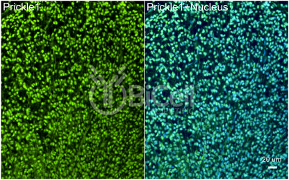 PRICKLE1 (RILP) Antibody - FFPE Validated