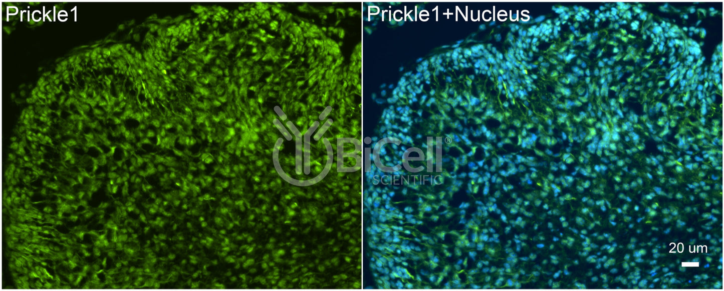 PRICKLE1 (RILP) Antibody - FFPE Validated