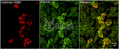 PTH1R Antibody - Western Blot Validated