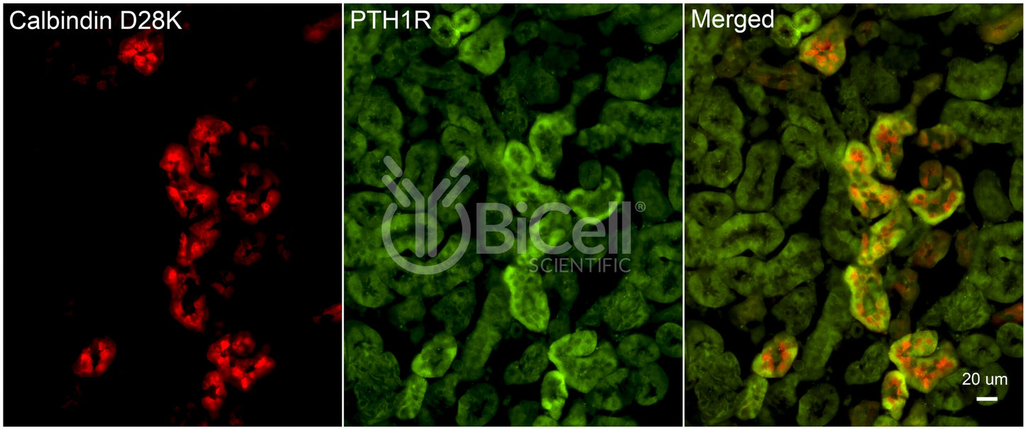 PTH1R Antibody - FFPE Validated