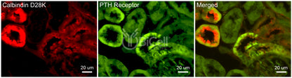 PTH1R Antibody - FFPE Validated