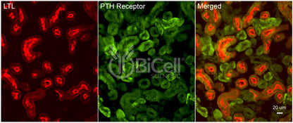 PTH1R Antibody - Western Blot Validated
