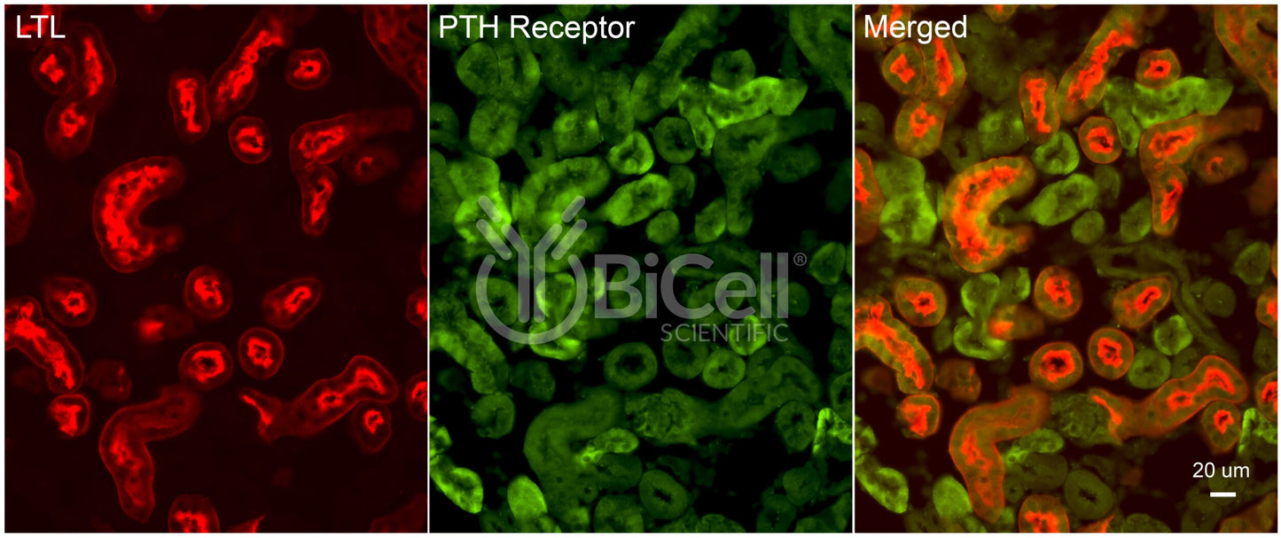 PTH1R Antibody - FFPE Validated