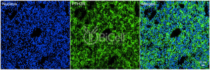 PTH2R Antibody - FFPE Validated
