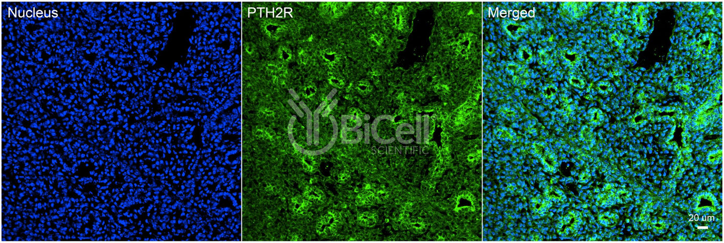 PTH2R Antibody - FFPE Validated