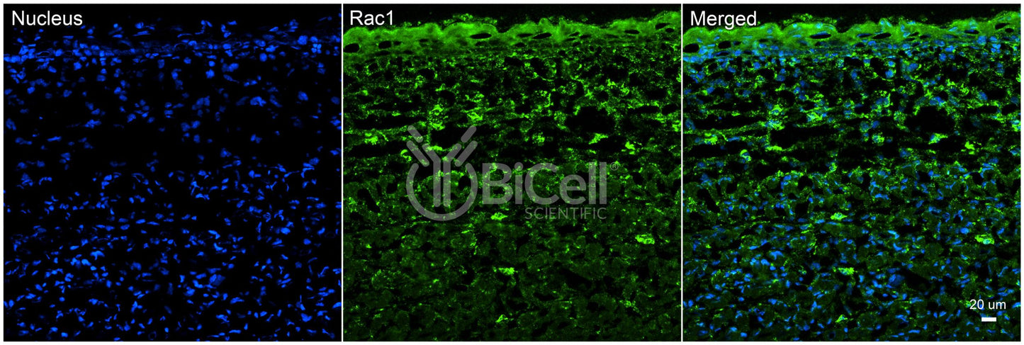 RAC1 Antibody - FFPE Validated