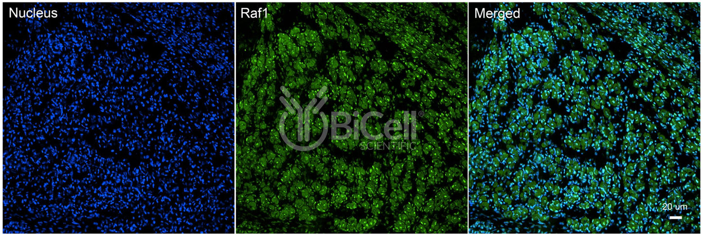RAF1 (c-Raf or CRAF) Antibody - FFPE Validated