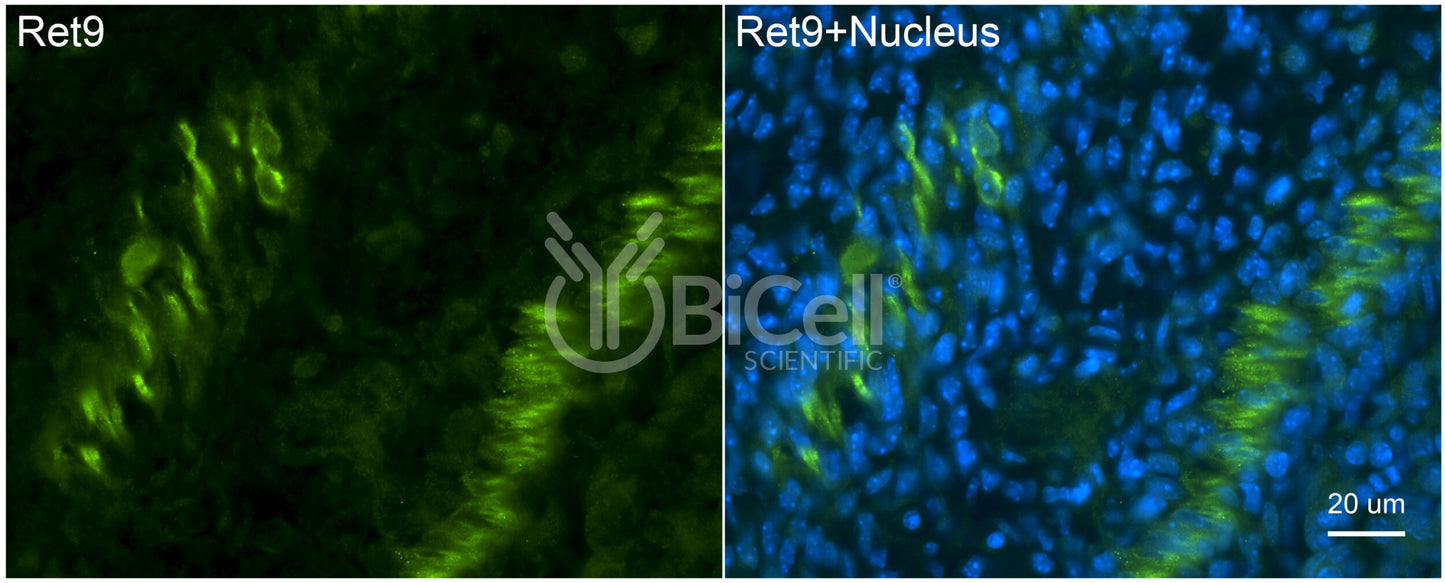 RET9 (RET or CDHF12 or CDHR16) Antibody - Western Blot Validated