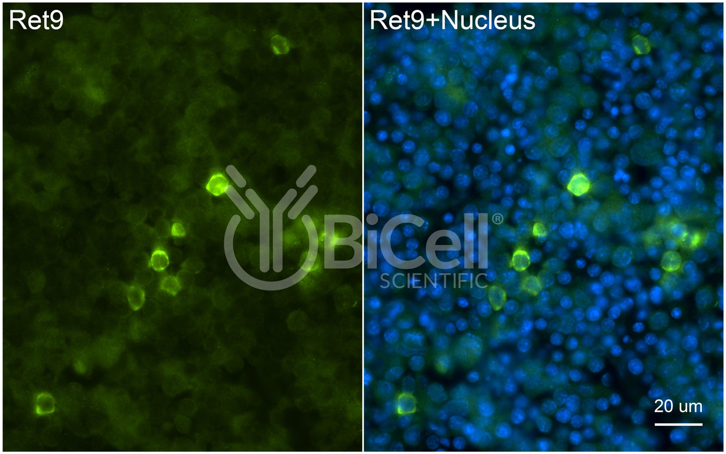 RET9 (RET or CDHF12 or CDHR16) Antibody - FFPE Validated