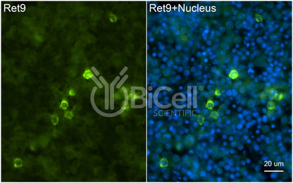 RET9 (RET or CDHF12 or CDHR16) Antibody - FFPE Validated