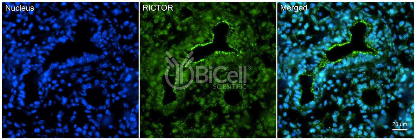 RICTOR Antibody - Western Blot Validated