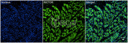 RICTOR Antibody - Western Blot Validated