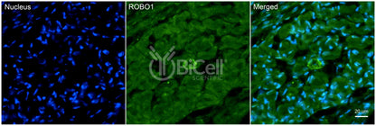 ROBO1 Antibody - Western Blot Validated