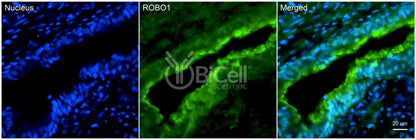 ROBO1 Antibody - Western Blot Validated