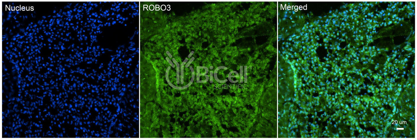 ROBO3 Antibody - FFPE Validated