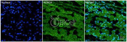 ROBO4 Antibody