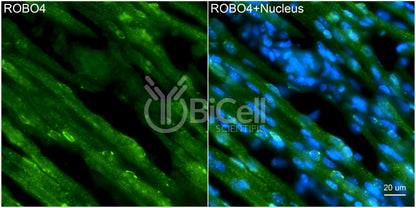 ROBO4 Antibody - FFPE Validated