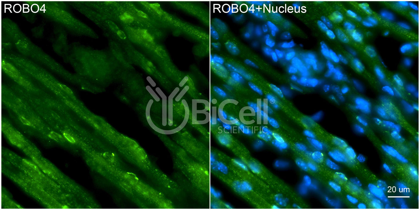ROBO4 Antibody