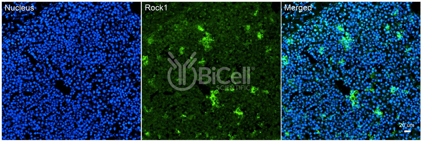 ROCK1 Antibody - FFPE Validated