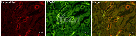 ROMK (Kir1.1 or KCNJ1) Antibody - Western Blot Validated
