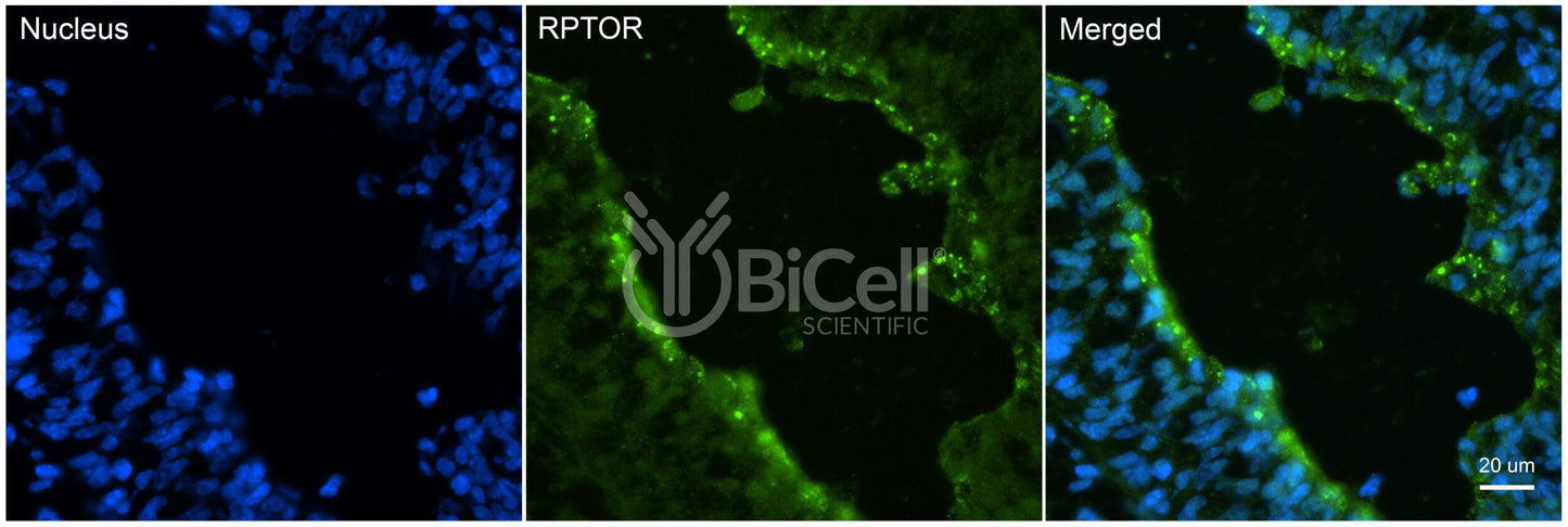 RPTOR Antibody - FFPE Validated