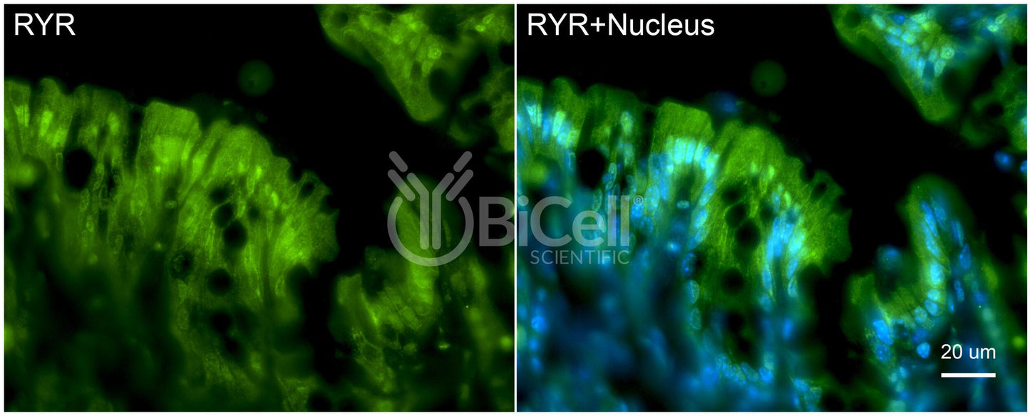 RYR1 (RYR) Antibody