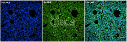 SATB2 Antibody