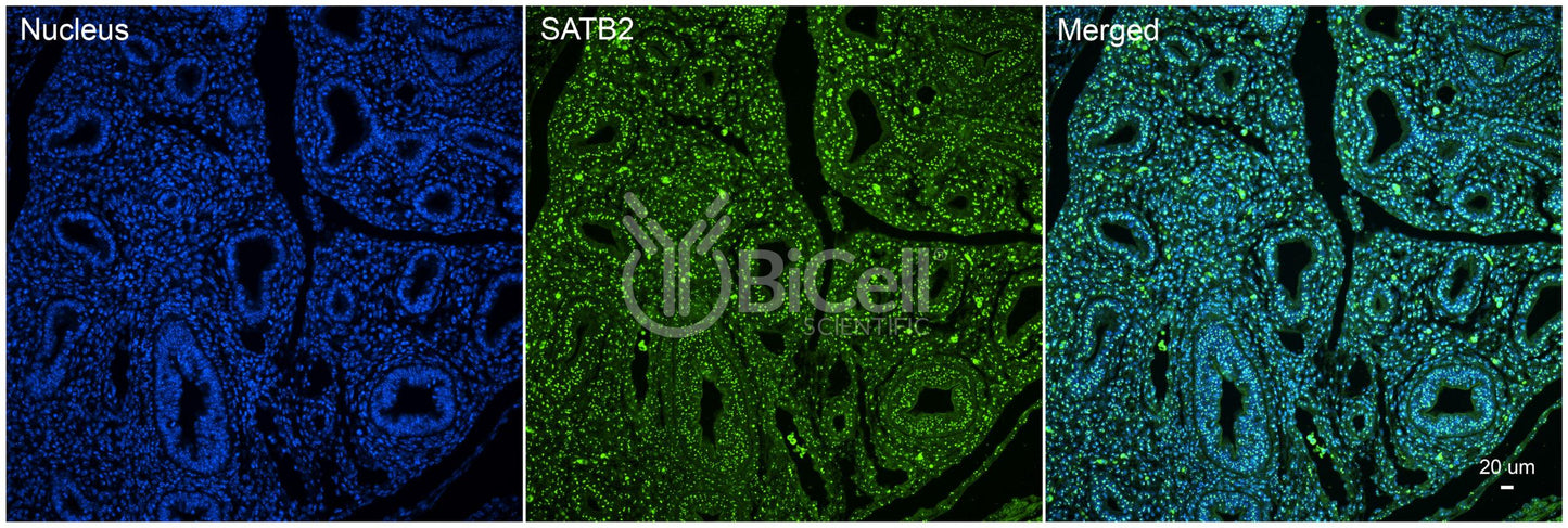 SATB2 Antibody - FFPE Validated