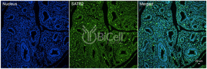 SATB2 Antibody - FFPE Validated