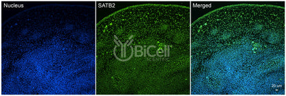 SATB2 Antibody