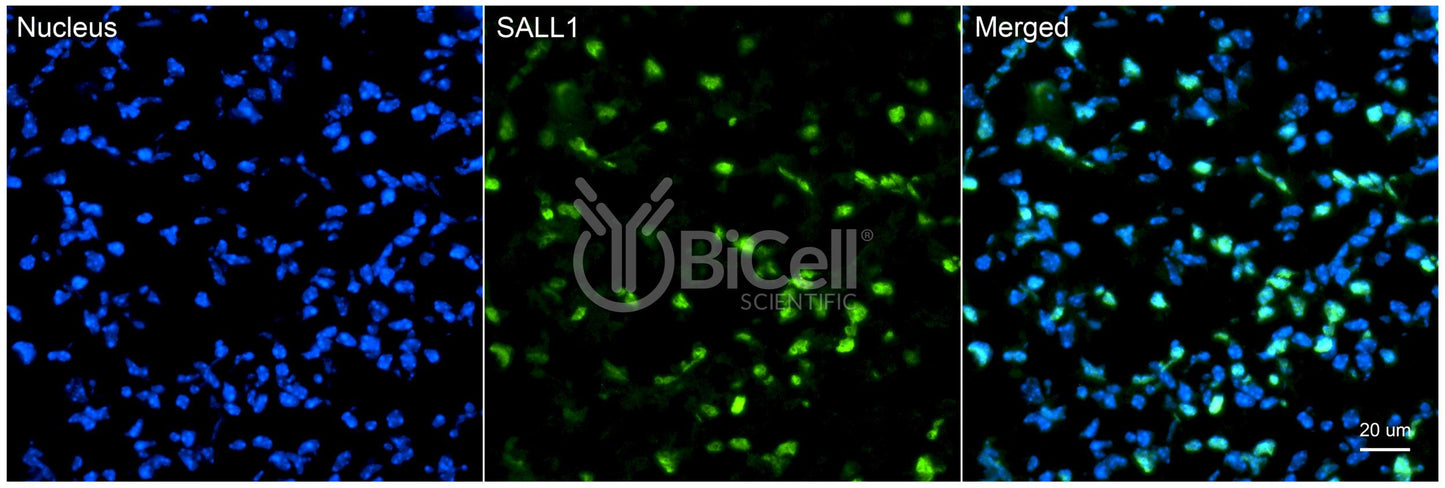 SALL1 Antibody - FFPE Validated