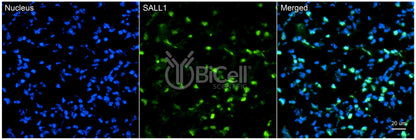 SALL1 Antibody - FFPE Validated