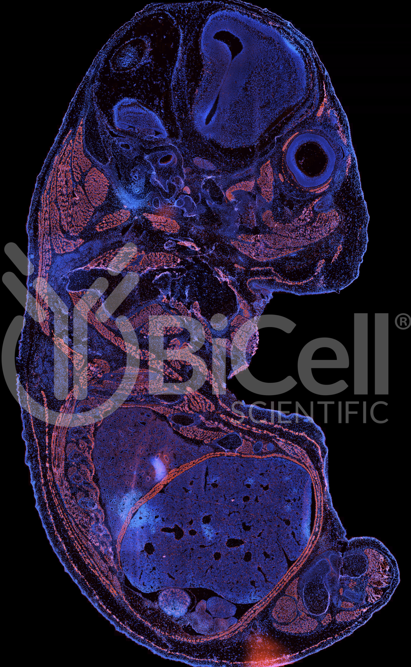 Desmin (DES) Antibody - FFPE Validated