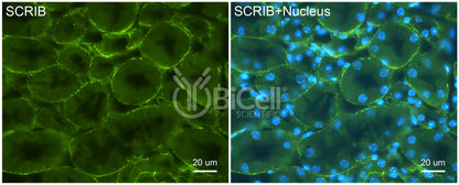 SCRIB (Scribble or SCRIBL) Antibody - Western Blot Validated