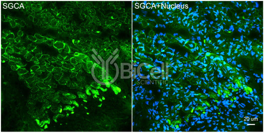Sarcoglycan Alpha (SGCA) Antibody - Western Blot Validated