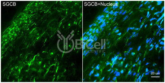 Sarcoglycan Beta (SGCB) Antibody - FFPE Validated