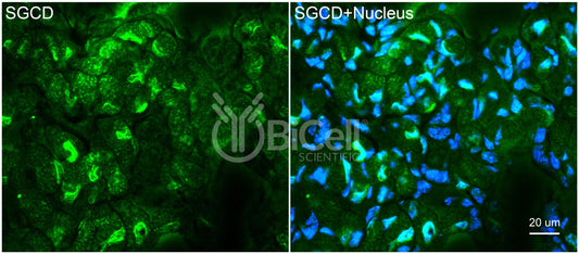Sarcoglycan Delta (SGCD) Antibody - FFPE Validated