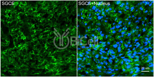 Sarcoglycan Epsilon (SGCE) Antibody - Western Blot Validated