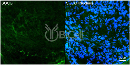 Sarcoglycan Gamma (SGCG) Antibody