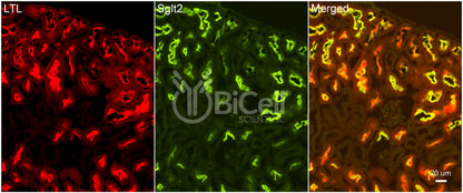 SGLT2 (Slc5a2) Antibody