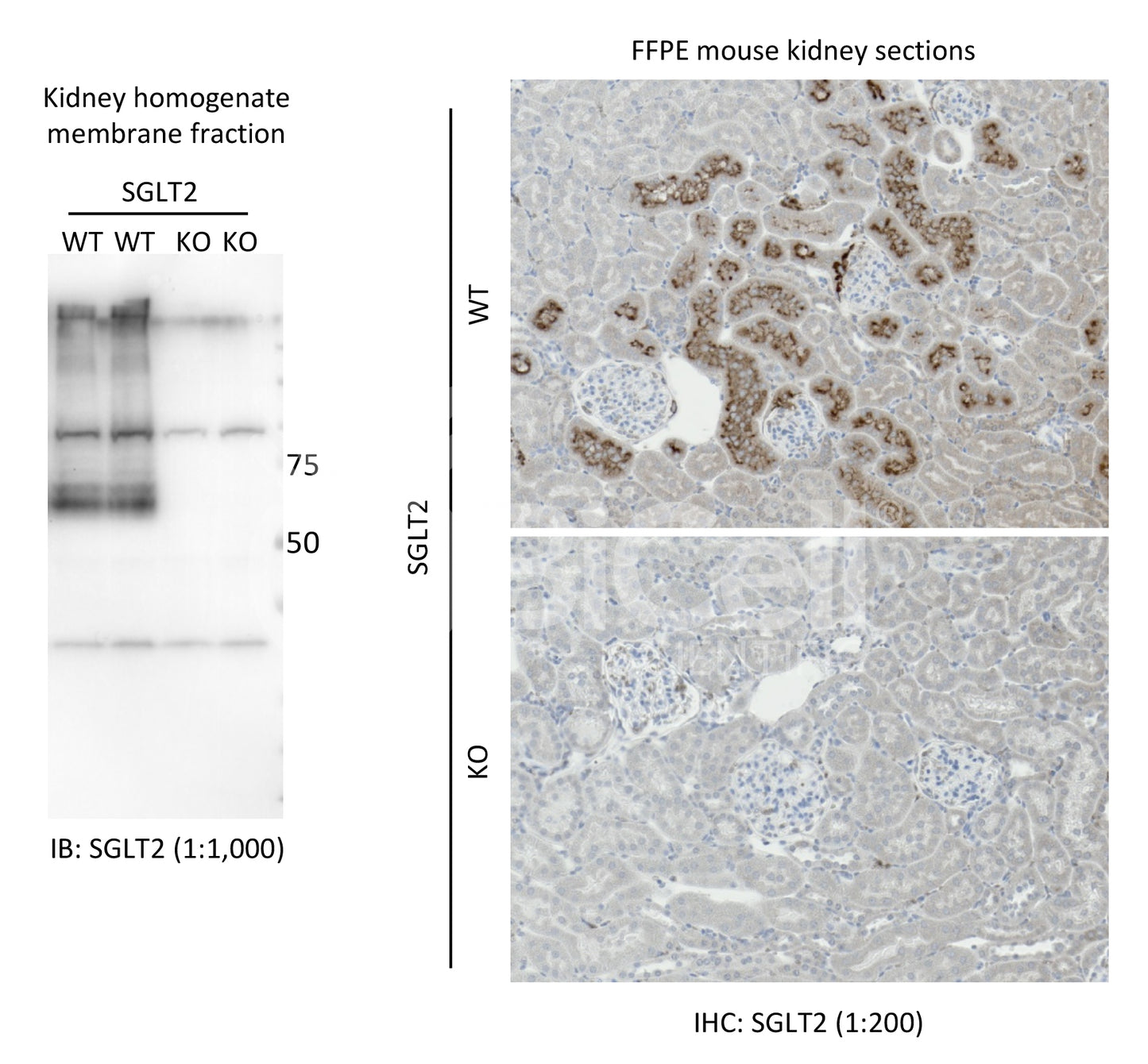 SGLT2 (Slc5a2) Antibody