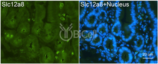 SLC12A8 (CCC9) Antibody