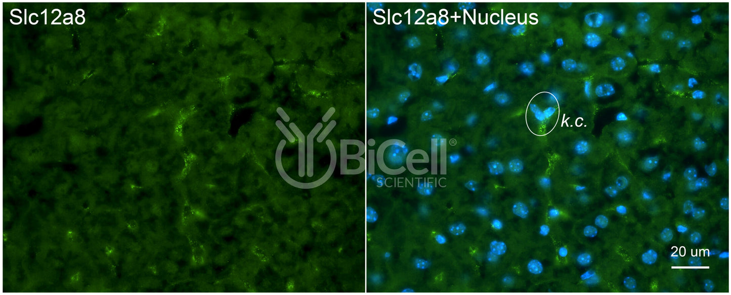 SLC12A8 (CCC9) Antibody - FFPE Validated