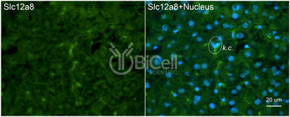 SLC12A8 (CCC9) Antibody - FFPE Validated