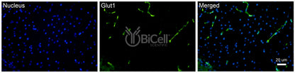 GLUT1 (SLC2A1) Antibody