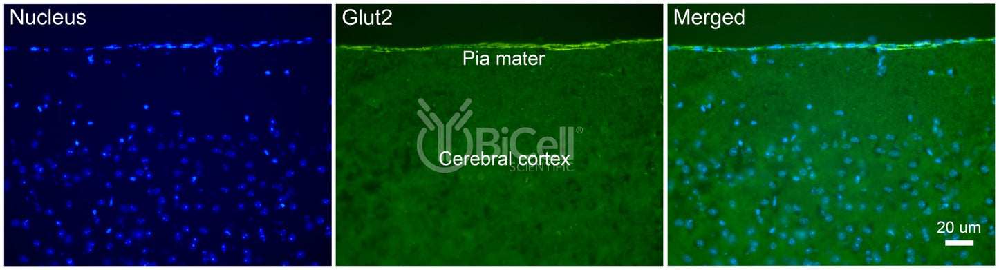 GLUT2 (SLC2A2) Antibody - FFPE Validated