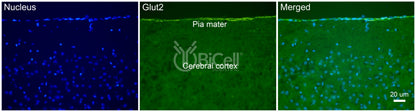 GLUT2 (SLC2A2) Antibody - FFPE Validated
