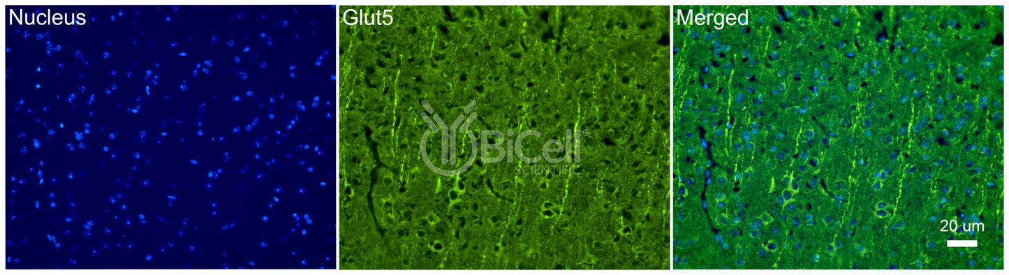 GLUT5 (SLC2A5) Antibody - FFPE Validated