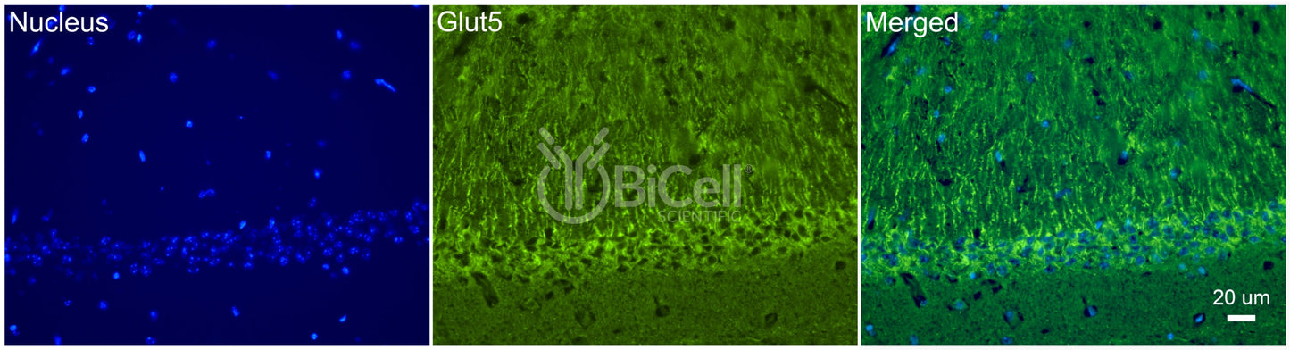 GLUT5 (SLC2A5) Antibody